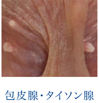 包皮腺・タイソン腺